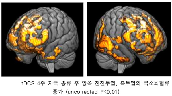 [2021.07.26] Watson & Company ‘Focus’, Increased Local Cerebral Blood Flow in Prefrontal Lobe and Te